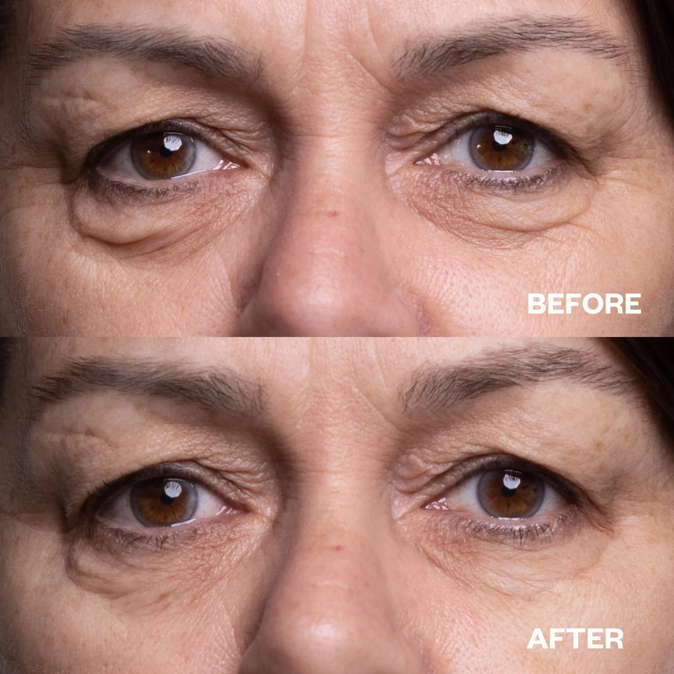 Wrinkles Schminkles Eye Patches